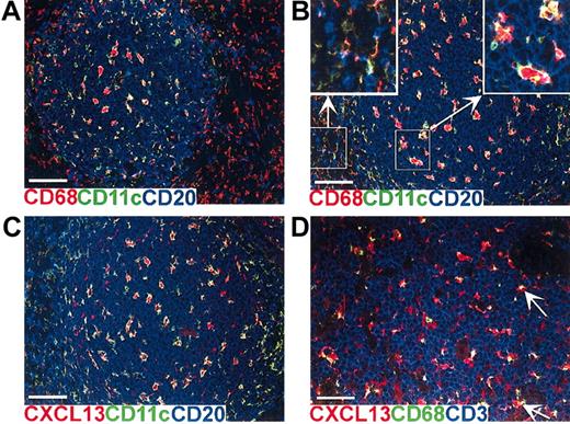 Figure 2. CXCL13-expressing cells in human lymphoid neogenesis and germinal centers of normal or aberrant human lymphoid tissue show macrophage phenotype. Multicolor immunofluorescence staining for CXCL13 and various markers (merged color separations; see keys). (A-B) All CD11c+ cells in follicles of UC lesion (A) and tonsil (B) with extensive germinal centers coexpress cytoplasmic CD68+ (right inset, enlarged cellular details). These cells appear red with yellow or green periphery because CD68 is intracellular, whereas CD11c is a surface marker. Outside of the CD20+ B-cell follicle are numerous purely red (CD68+CD11c–) macrophages in UC (A), whereas scattered red macrophages and abundant purely green dendritic cells (CD11c+CD68–) are seen in the extrafollicular area of tonsil (left inset, enlarged cellular details). Macrophages sometimes appear yellowish because of weak coexpression of CD11c. (C) CXCL13 is localized to the cytoplasm of CD11c+ cells in tonsillar germinal center; comparable field from section adjacent to panel B. (D) CXCL13-expressing scattered cells in dense collections of T cells (CD3+) are CD68+ (arrows) in UC lesion. Bars represent 100 μm (A-C) and 50 μm (D).