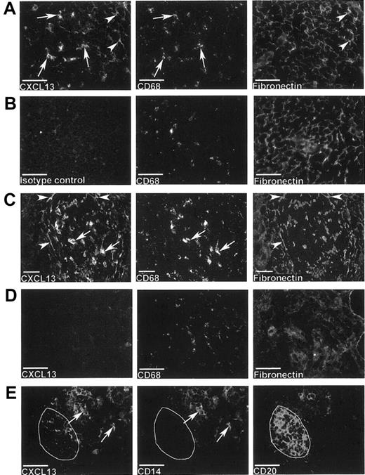 Figure 3. Recently recruited and mature macrophages express CXCL13 that is also associated with extracellular fibrils. Single exposures of multicolor immunofluorescence staining for CXCL13 and various markers (see keys) in inflammatory lesions or germinal centers of normal lymphoid tissue. (A) CXCL13-expressing CD68+ macrophages (arrows) in UC lesion, where the CXCL13+ meshwork colocalizes with fibronectin (arrowheads). (B) Concentration-matched isotype control for anti-CXCL13 mAb; comparable field from section adjacent to panel A. (C) CXCL13-expressing CD68+ macrophages in tonsillar germinal center (arrow) and fibronectin-bearing fibrils with associated CXCL13 (arrowhead). (D) CD68+ macrophages in celiac disease lesion do not express CXCL13. (E) CXCL13-expressing CD14+ cells (arrows) near small CD20+ B-cell follicle (delineated); CXCL13-expressing cells are also present within the follicle where no CD14+ cells are seen. Bars represent 50 μm.