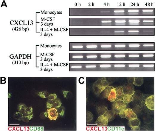 Figure 4. Monocytes, freshly isolated or matured in vitro with M-CSF, express CXCL13 mRNA after LPS stimulation. (A) RT-PCR analysis of freshly isolated monocytes (top panel) and monocytes cultured for 3 days with either M-CSF (middle panel) or IL-4 and GM-CSF (bottom panel). Cells were stimulated with LPS (100 ng/mL) before total RNA was isolated at different time points after stimulation as indicated (2-48 hours). Representative results from 3 independent experiments are displayed in comparison with the expression levels of the “housekeeping” gene GAPDH in the same cultures. (B-C) Immunofluorescence staining of freshly isolated monocytes (B) and monocytes matured in vitro for 3 days with M-CSF (C). After 24 hours of LPS stimulation, the cells were stained for the markers indicated (merged color separations; see keys). Bars represent 20 μm.
