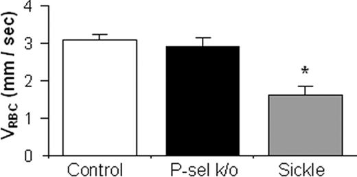 Figure 1. Baseline RBC velocity (VRBC) of XRITC-labeled sickle RBCs injected into mouse recipients expected to have different levels of endothelial P-selectin expression. CAIM flow data from visualization of 20 to 40 μm diameter mucosal-intestinal venules are represented as the average VRBC of XRITC-labeled RBCs. Labeled sickle RBCs were injected intravenously into C57BL/6 (control; n = 24), P-selectin knock-out (P-sel k/o; n = 9), and sickle cell mice (n = 10). The error bars indicate the standard error of the mean. * indicates a statistically significant (P < .05) difference from the other groups.
