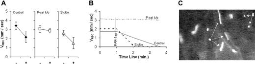 Figure 2. The effect of PAR-1 agonist peptide on RBC velocity (VRBC) of XRITC-labeled sickle RBCs injected into mouse recipients expected to have different levels of endothelial P-selectin expression. Results are described as VRBC in C57BL/6 (control), P-selectin knock-out (P-sel k/o), and sickle cell mice. (A) Average VRBC of labeled sickle RBCs in control (n = 5), P-selectin knock-out (n = 5), and sickle cell mice (n = 4) before (-) and 2 minutes after (+) PAR-1 agonist peptide suffusion. The error bars indicate the standard error of the mean. (B) Real-time course plots of RBC velocity (VRBC) slowing due to PAR-1 agonist peptide (PAR-1ap) suffusion. Each plot represents a single representative experiment. (C) A single frame captured of labeled sickle RBCs in PAR-1 agonist peptide-treated vessels. Sickle RBCs moving rapidly (*) and rolling slowly (#) are indicated.