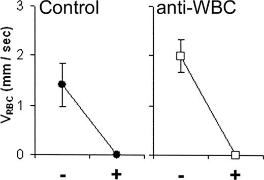 Figure 5. The effect of pretreatment with a combination of anti-L-selectin, anti-PSGL-1, and anti-β2 integrin mAbs (anti-WBC) on PAR-1 agonist peptide-reduced RBC velocity (VRBC) of XRITC-labeled sickle RBCs injected into C57BL/6 (control) mice. Results described are VRBC. Average velocities of labeled sickle RBCs (VRBC) in control (n = 6) or combination antibody-treated (n = 12) mice before (-) and 2 minutes after (+) PAR-1 agonist peptide suffusion. The error bars indicate the standard error of the mean.