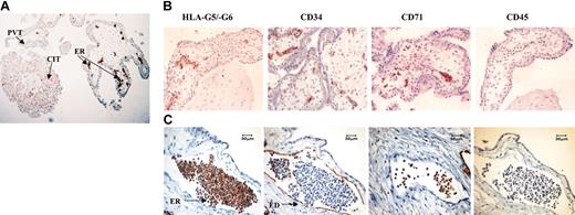 Figure 1. Localization of HLA-G proteins in erythroid cells from first-trimester trophoblast by immunohistochemistry. (A) Expression of soluble HLA-G5/-G6 by cell island trophoblast (CIT) and by erythroid (ER) cells but not by perivillous trophoblast (PVT) was determined by using the 5A6G7 mAb. (B) Analysis of HLA-G5/-G6, CD34, CD71, and CD45 expression on the developing vessels present in first-trimester trophoblast tissue. (C) Immunohistochemical staining of serial trophoblast sections of a differentiated vessel from a 32-day embryo. Analysis was performed by using antibodies to HLA-G5/-G6 (5A6G7 mAb), CD34 which marks endothelial (ED) cells lining vessel, CD71 which identifies erythroid (ER) cells, and CD45 which targets both lymphoid and myeloid cells. Original magnifications: × 100 (A), × 200 (B), and × 400 (C).