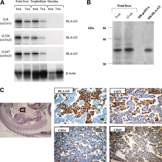 Figure 3. HLA-G5 is the HLA-G isoform present in erythroid cells from fetal liver. (A) Identification of HLA-G5 transcript in liver from 6-week (6w) and 7-week (7w) fetuses was determined by RT-PCR analysis and subsequent hybridizations. Specific amplification of soluble HLA-G was conducted by using forward primer CP5 and G.2734 primer sets. HLA-G products were detected by using either the G.R probe (specific for exon 2 encoding the α1 extracellular domain), the G.526 probe (specific for exon 3 encoding the α2 domain), or the G.647 probe (specific for exon 4 encoding the α3 domain). β-Actin products were amplified in the same reaction and were detected by using aβ-actin probe. Trophoblast villi from the same fetus and decidua from the corresponding mother were used as positive and negative controls of HLA-G gene transcription, respectively. (B) Identification of the 37-kDa HLA-G5 isoform was determined by running 1/25 of the total proteins extracted from 2 fetal livers of 9 weeks (9w) and 12 weeks (12w) on a 12% SDS-PAGE (polyacrylamide gel electrophoresis) gel followed by immunoblotting with the 5A6G7 mAb. The M8-HLA-G5 or M8-pcDNA transfectants were used as HLA-G5–positive and –negative controls, respectively. (C) Hematoxylin Eosin-Safran (HES) coloration of a paraffin-embedded 32-day embryo section (left) localizes the region of the liver for which higher magnifications of the same liver region stained with antibodies to CD34, HLA-G5, CD45, and CD71 are represented (right panel). HLA-G5 is detected in the erythroid cells which originate from the YS and are present in the lumen of sinusoids (embryo capillaries). The CD34 is positive in endothelial cells. Left panel is shown at × 20 original magnification; right panels are shown at × 400.