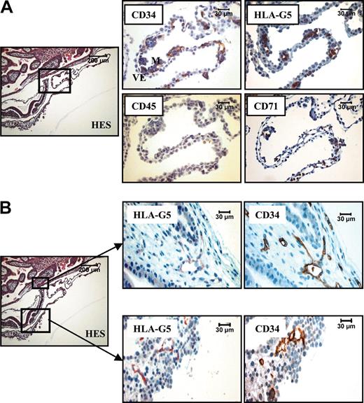 Figure 4. HLA-G5 is present in erythroid and endothelial cells from a 16-day embryo. (A) Hematoxylin Eosin-Safran (HES) coloration of a paraffin-embedded 16-day embryo section (left) localizes the region of the YS for which higher magnifications of the same YS region stained with antibodies to CD34, HLA-G5, CD45, and CD71 are represented (right panel). Visceral endoderm and mesoderm are identified by VE and M, respectively, in the CD34 box. (B) The top boxed area is the chorionic plate (left) for which higher magnifications of the same region stained with antibodies to HLA-G5 and CD34 are represented (top right panel). The bottom area is the closed mesoderm (YS) (left) for which higher magnifications of the same region stained with antibodies to HLA-G5 and CD34 are represented (bottom right panel). In both localizations, HLA-G5 stains the CD34-positive endothelial cells. In both A and B, left panels are shown at × 100, and right panels at × 400.