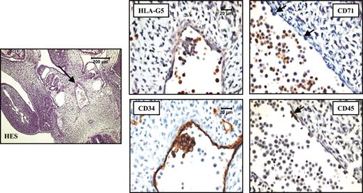 Figure 5. HLA-G5 localizes in the erythroid cells in AGM from a 32-day embryo. HES coloration of a 32-day-paraffin-embedded embryo section (left) permits the localization of the AGM (arrow) for which higher magnifications of the same AGM region stained with antibodies to HLA-G5/-G6, CD71, CD34, and CD45 are represented (right panel). HLA-G5 staining was examined regarding the CD71-expressing erythroid cells that flow in the aorta, the CD34-positive endothelial cells lining the aorta, and the CD34- and CD45-positive pluripotent stem cells which form a cluster associated to the ventral wall of the dorsal aorta. The arrows point to the few residual pluripotent stem cells in the sections stained with the anti-CD71 or anti-CD45 mAb. Left panel is shown at× 100, and right panels at × 600.