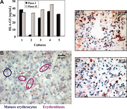 Figure 6. HLA-G5 is secreted by erythroblasts but not by mature erythrocytes. (A) Detection of HLA-G5 in the supernatants of a 2-phase liquid culture from light-density cord blood cells using an HLA-G5-specific ELISA. The culture supernatant of M8-HLA-G5 cells was used as positive control and HLA-G5 concentration was more than 70 ng/mL. No HLA-G5 proteins were detected in the culture supernatant of KG1a leukemic cells used as negative control. (B) Immunolocalization of HLA-G5 in erythroblasts but not in mature erythrocytes from a 16-week fetal liver. Magnification is × 600. (C) Immunohistochemistry analysis of 16-week fetal BM using the 5A6G7 mAb. (D) Immunohistochemistry analysis of HLA-G5 expression by erythroid cells on paraffin-embedded bone marrow section from an 82-year-old adult. Magnification is × 400 in panels C and D.