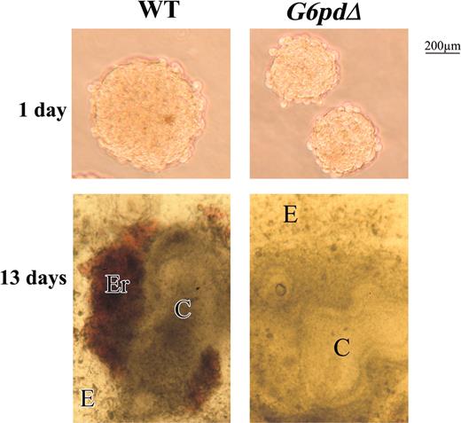 Figure 1. WT and G6pdΔ EB morphology. EBs formed from WT and G6pdΔ ES cells by hanging drops on days 1 and 13 of differentiation. Note that the smaller EBs derived from G6pdΔ cells at day 1 of differentiation, and the absence of red foci in EBs derived from G6pdΔ at 13 days of differentiation. Photomicrographs were obtained in culture media with a Zeiss (Jena, Germany) Stemi SV11 stereomicroscope at 5 × numerical aperture and 10 × magnification of the Zeiss objective lenses (Jena, Germany).