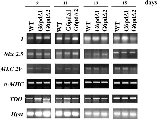 Figure 3. Analysis for markers of differentiated tissues. Ethidium bromide–stained gels of RT-PCR amplification using various marker genes of differentiation. RNA was extracted from EBs derived from WT ES cells (WT) and from 2 different G6pdΔ ES cell lines (G6pdΔ1 and G6pdΔ2). Number of days in culture is given at the top. Amplified Hprt is shown as a positive control.