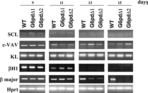 Figure 4. Analysis for markers of hematopoietic differentiation. Ethidium bromide–stained gels of RT-PCR amplification using various marker genes of hematopoietic differentiation. RNA was extracted from EBs derived from WT ES cells (WT) and from 2 different G6pdΔ ES cell lines (G6pdΔ1 and G6pdΔ2). Numbers referring to the days of EB development are shown at the top of the figure. Amplified Hprt is shown as a positive control.