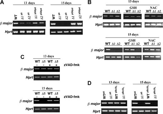 Figure 6. Relationship between β-major globin transcript and erythropoietic defect in G6pdΔ EBs. RT-PCR analysis of β-major RNA expression. (A) EBs derived from WT and G6pdΔ ES cell lines stably transfected with Pallino β-actin empty vector (WT and G6pdΔp0) or with Pallino β-actin G6pd expression vector (G6pdΔpG6pd) at days 13 and 15 of differentiation. RNA from WT ES cells (WT), 2 different cell lines of G6pdΔp0 (Δ1p0, Δ2p0) and G6pdΔpG6pd (Δ1pG6pd, Δ2pG6pd) were used in this experiment. (B) EB growth in the presence of 2.5 mM NAC or 2.5 mM GSH from day 11 of differentiation. EBs were harvested at 13 or 15 days of development. RNA was extracted from EBs derived from WT ES cells (WT) and from 2 different G6pdΔ ES cell lines (Δ1, Δ2). (C) EBs derived from WT ES cells (WT) and G6pdΔ ES cells (Δ1) were treated with 100 μM broad-range caspase inhibitor z-VAD-fmk from day 11 of differentiation. After 13 and 15 days of development, the EBs were harvested and assayed for β-major RNA expression. (D) EBs derived from WT and G6pdΔ ES cell lines stably transfected with Pallino β-actin empty vector (WTp0 and G6pdΔp0) or with Pallino β-actin BclXL expression vector (WTpBclXL and G6pdΔpBclXL). RNA used in this experiment was extracted from EBs derived from WTp0 G6pdΔp0 (Δ1p0), WTpBclXL, and G6pdΔpBclXL (Δ1pBclXL) ES cells at days 13 and 15 of differentiation. Amplified Hprt is shown as a positive control.
