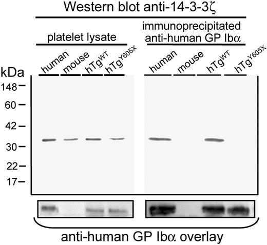 Figure 2. Truncation of platelet GP Ibα at Tyr605 ablates the interaction between GP Ibα and 14-3-3ξ. (Left) Western blot of platelet lysates detecting 14-3-3ξ protein at approximately 32 kDa in human platelets, mouse platelets, and mouse platelets expressing human GP Ibα subunits but devoid of mouse GP Ibα (hTgWT and hTgY605X). The experiment demonstrated that total levels of 14-3-3ξ were similar in each of the samples. (Right) Results obtained after immunoprecipitation of human GP Ibα. Bound anti–14-3-3ξ antibody was detected using radiolabeled goat anti–rabbit IgG. Results demonstrate that the truncation of GP Ibα ablated the interaction with 14-3-3ξ, as evidenced by the lack of 14-3-3ξ antigen. Longer exposures of the autoradiograph failed to detect any 14-3-3ξ antigen in the hTgY605X sample. The same nitrocellulose filter was probed a second time with an anti–human GP Ibα monoclonal antibody, LJ-Ibα1, and demonstrated the presence of GP Ibα antigen in those samples in which the human subunit was present (bottom panel).