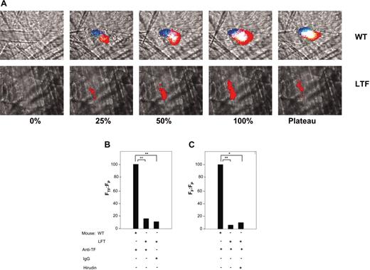 Figure 2. Platelet, TF, and fibrin deposition in thrombi of wild-type and low TF mice. (A) TF, fibrin, and platelet colocalization in a representative thrombus in a low TF mouse and a wild-type mouse. Upper panels are wild-type mouse; lower panels, low TF mouse. TF was detected with an anti–mouse TF antibody and Alexa 488–conjugated chicken anti–rabbit IgG. An Alexa 660–conjugated rat anti–mouse CD41 and an Alexa 350–conjugated anti–mouse fibrin antibody labeled the platelets and fibrin, respectively. In all experiments, infusion of anti-CD41 was used to detect platelets and antifibrin-specific antibodies were used to detect fibrin. Anti-TF antibodies or irrelevant IgG were infused, as indicated. The thrombus is shown at varying stages of its development: 0%, before vessel wall injury; at 25% of maximal thrombus size; at 50% of maximal thrombus size (early phase); at 100% (peak) thrombus size; and at the plateau phase. Intravital 4-channel video images depict the accumulation of platelets (red), TF (green), and fibrin (blue) as well as the colocalization of TF and platelets (yellow), platelets and fibrin (magenta), TF and fibrin (turquoise), and all 3 components (white). (B) Ratio of the integrated fluorescence intensity associated with tissue factor (FTF) to the integrated fluorescence intensity associated with platelets (FP) in thrombi generated in wild-type and low TF mice. All values are depicted as a percentage of the integrated fluorescence intensity in wild-type mice. Nonspecific background fluorescence was determined using a nonimmune rabbit IgG. (C) Ratio of the integrated fluorescence intensity associated with fibrin (FF) to integrated fluorescence intensity associated with platelets (FP) in thrombi formed in low TF and wild-type mice. The integrated fluorescence intensity in the absence of fibrin formation was determined in a low TF mouse treated with hirudin (2 U/g body weight). All values shown are median values. In panels B and C, 3 mice of each genotype were used in these experiments to generate 19 thrombi in wild-type mice (WT), 18 thrombi in low TF mice (LTF), and 8 thrombi in low TF mice treated with an irrelevant antibody or with hirudin. *P < .05; **P < .025 with respect to wild-type mice. Anti-TF indicates antitissue factor antibodies.