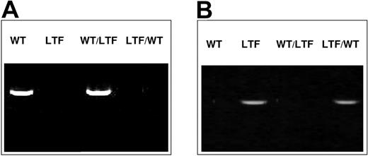 Figure 3. Genotype analyses of blood cells from wild-type, low TF, and chimeric mice. PCR was performed on whole blood. (A) PCR using primers for the mouse TF gene. (B) PCR using primers for the human TF gene. WT indicates wild-type mouse; LTF, low TF mouse; WT/LTF, wild-type bone marrow/low TF mouse; LTF/WT, low TF bone marrow/wild-type mouse. All mice used were individually tested.