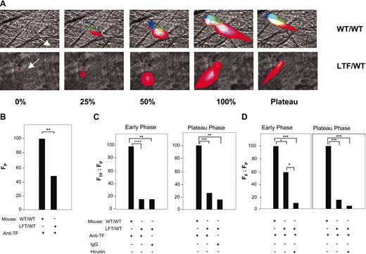 Figure 4. TF, fibrin, and platelet accumulation in thrombi of wild type mice that received transplants of bone marrow from wild type (WT/WT) or low-TF (LTF/WT) mice. In all experiments, infusion of anti-CD41 was used to detect platelets and antifibrin-specific antibodies were used to detect fibrin. Anti-TF antibodies or irrelevant IgG were infused, as indicated. (A) The thrombus is shown at varying stages of its development as described in Figure 2A. The direction of blood flow is indicated by the white arrow. Top panels are from wild-type bone marrow in a wild-type recipient mouse (WT/WT). Bottom panels show the LTF/WT chimeric mouse. Intravital 4-channel images are as described in Figure 2A. (B) Platelet accumulation. Median values of platelet fluorescence of 32 thrombi from 3 WT/WT mice and 30 thrombi from 4 LTF/WT chimeric mice. (C) Ratio of integrated fluorescence intensity associated with TF to the integrated fluorescence intensity associated with platelets in WT/WT mice. The background fluorescence was determined with a fluorescently labeled nonimmune rabbit IgG. All values shown are median values. WT/WT; 15 thrombi; LTF/WT chimeras, 15 thrombi; and background antibody fluorescence in LTF/WT chimeras, 15 thrombi. Left panel, early phase; right panel, plateau phase. (D) Ratio of integrated fluorescence intensity associated with fibrin to the integrated fluorescence intensity associated with platelets in thrombi formed in WT/WT mice and LTF/WT chimeric mice. Background fluorescence was determined after infusing hirudin (2 U/g body weight) to block fibrin formation. WT/WT, 26 thrombi in 3 mice; LTF/WT chimeric mice, 17 thrombi in 2 mice; and LTF/WT background antibody fluorescence in LTF/WT chimeras, 26 thrombi in 3 mice. Left panel, early phase; right panel, plateau phase. *P < .05; **P < .025; ***P < .0025; ****P < .0005.