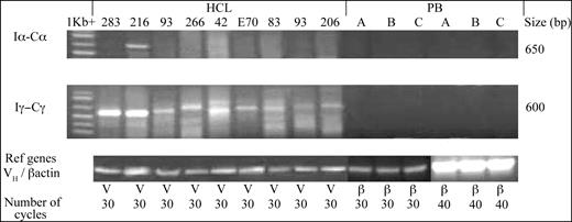Figure 2. Analysis of sterile germ line switch transcripts in HCL expressing multiple sIg isotypes. Germline transcripts are transcribed from I exon promoters during initiation of isotype-switching events, and splicing generates Iα-Cα and Iγ-Cγ transcripts. Germline transcripts were sought in our HCL cases by using RT-PCR employing primers and assay conditions as reported.17 Both Iα-Cα and Iγ-Cγ transcripts of predicted size, as indicated, were identified and paralleled sIg expression in each case. Each RT-PCR product was excised and sequenced to verify the identity of transcripts. Minor bands in a few cases were shown by sequence analysis to be unrelated nonspecific amplification products. To exclude contamination from normal circulating lymphocytes, germ line transcripts were also assayed in cDNA generated from 3 healthy peripheral lymphocyte control preparations (labeled A, B, or C), and these were found to be negative even when 40 PCR cycles were used. Template cDNA levels were compared by reference VH (V) or β-actin (β) genes as shown.