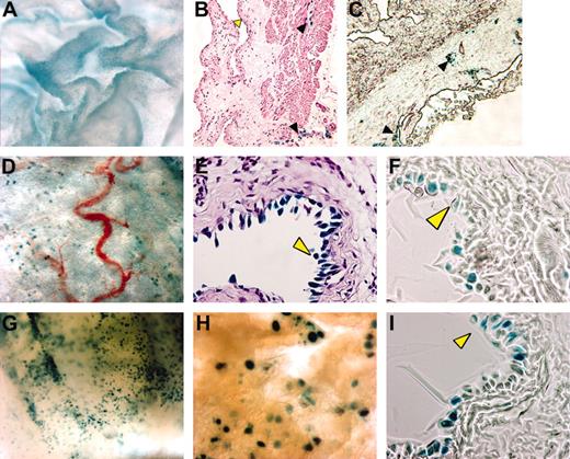 Figure 2. Visualization of TNF-α– and LPS-induced bladder NF-κB activity. Anesthetized female κB-lacZ mice were challenged intravesically with saline (A-C), LPS (100 μg/mL; D-F), or TNF-α (1 μg/mL; G-I). Twenty-four hours after challenge, bladders were removed and stained with X-gal and photographed as whole mounts (A,D,G-H) or cross-sections (B-C,E-F,I). Tissues were stained with hematoxylin and eosin (B,E) or left unstained (C,F,I). Yellow arrowhead indicates urothelial cells and black arrowhead indicates lymphatic vessels. Cross-sections were visualized with a Nikon compound Eclipse E600 microscope equipped with PlanFluor 40×/0.75 DIC m objective lenses (Nikon). Images were viewed in open air at the following magnifications: A, 300×; B and C, 100×;D,30×; E, F, and I, 400×;G,40×; and H, 60×.