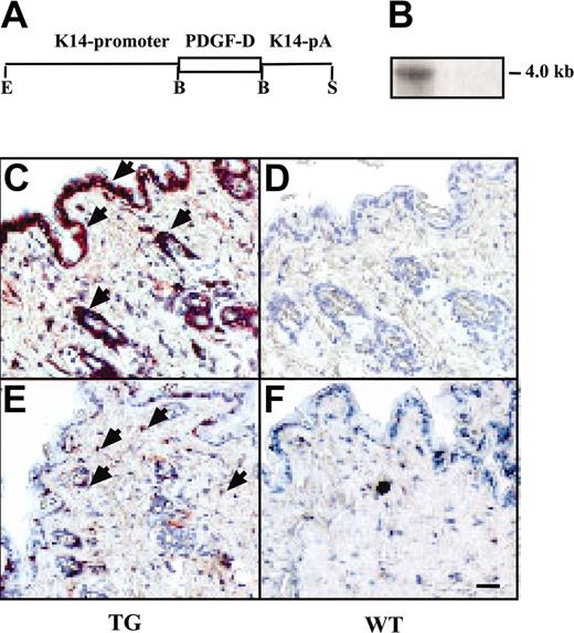 Figure 1. Expression and macrophage recruitment by the K14-PDGF-D transgene. (A) A schematic figure of the K14-PDGF-D construct. (B) Northern blot of total skin RNA from transgenic (TG) and wild-type (WT) mice hybridized with a radioactive PDGF-D probe. Equal loading of the 2 lanes was confirmed by ethidium bromide staining of RNA. Immunostaining of the TG and WT skin for PDGF-D. (C) Arrowheads point to the positive basal epidermal and hair follicle cells; compare with panel D. (E-F) Staining for F4/F80 in the TG and WT skin. (E) Arrowheads indicate the macrophages (original magnification, × 200). Bar represents 60 μm.