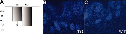Figure 2. Dermal IFP and cellular density in PDGF-D–overexpressing mice. (A) The IFP measured from the dermis was between –1.1 and –2.1 mm Hg (± 0.065) in wild-type mice and between –1.0 and –1.5 (± 0.136) in transgenic mice. This difference was statistically significant (n = 7 in both groups; *P = .0175). (B-C; data not shown) The staining of nuclei was used to calculate cell density in the skin (original magnification, × 200). Careful counting indicated no difference in the cell densities between the transgenic and wild-type mice.