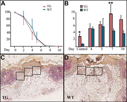Figure 3. Wound healing and macrophage numbers in K14-PDGF-D and control mice. (A) Kinetics of wound closure in the transgenic mice and wild-type littermates (mean ± SD). (B) Total number of macrophages in the wound area in transgenic mice and their littermates at various days of the healing process (*P = .0227; **P = .0364; day 4, n = 5; days 5, 7, n = 4; day 10, n = 3). Values are expressed as mean ± SD. (C-D) Typical wounds from day 7. Boxed areas show examples of the areas from which the total cell counts and macrophage counts were obtained (1 box = 4 × 104 μm2) (original magnification, × 40).