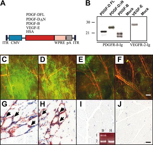 Figure 4. AAV-PDGF-D induces macrophage accumulation in skeletal muscle. (A) Schematic representation of the AAV constructs. Human PDGF-DFL, PDGF-DΔN, VEGF-E, and HSA cDNAs were driven by the CMV promoter and early enhancer and were followed by the Woodchuck posttranscriptional enhancer-element (WPRE) and the SV40 polyadenylation signal (pA). (B) In vitro expression analysis of the AAV vectors in HeLa cell cultures. PDGFs were precipitated from the media of the AAV-transduced cells with PDGFR-β immunoglobulin, and VEGF-E was precipitated with VEGFR-2 immunoglobulin. Fluorescence photomicrographs from the ears of mice that received transplanted GFP-marked bone marrow cells from a donor of the same mouse strain. Ears were injected with (C) AAV-PDGF-DFL, (D) AAV-PDGF-DΔN, (E) AAV-PDGF-B, or (F) PBS. Note the strong accumulation of GFP-positive cells in the ears expressing PDGF-D (original magnification, × 50). Staining of the macrophage antigen F4/F80 in mice injected with (G) AAV-PDGF-DFL and (H) AAV-PDGF-DΔN compared with (I-J) AAV-PDGF-B or PBS control (original magnification, × 200). (I, inset) Human PDGF-B (lane 1) and β-actin (lane 2) RT-PCR from RNA extracted from (B) AAV-PDGF-B– and (H) AAV-HSA–injected muscle. Bars represent 230 μm (F) and 20 μm (J).