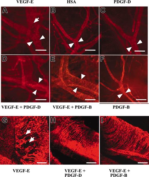 Figure 5. PDGF-D repairs the disorganized SMC coating of VEGF-E–induced blood vessels. Whole-mount staining for SMA of AAV-infected ears. Note that the AAV-VEGF-E–infected ears show enlarged vessels (arrowheads) a loose, irregular coating by (A, G, arrows) SMCs in comparison with (B) AAV-HSA. A combination of AAV-VEGF-E with AAV-PDGF-D (D, H) or AAV-PDGF-B (E, I) reestablishes the normal tight structure typical of the SMC layer of arteries. The SMC layer in (C) AAV-PDGF-D– or (F) AAV-PDGF-B–injected tissue shows no apparent changes from the control (original magnification: × 100 for A-F, and × 400 for G, I). Bars represent 150 μm (A-F) and 30 μm (G-I).