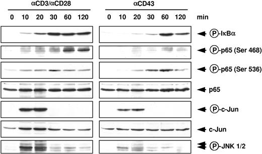 Figure 1. Comparative analysis of CD43-and T-cell costimulation-induced signaling pathways in human peripheral T lymphocytes. Cells were stimulated for the indicated periods with agonistic αCD43 or αCD3/CD28 antibodies and lysed. Equal amounts of protein contained in total cell extracts were analyzed by immunoblotting. The occurrence of p65 and c-Jun was revealed with specific antibodies; phosphorylation of endogenous proteins was revealed by phosphospecific antibodies detecting phosphorylated forms of p65, IκBα, c-Jun, and Jun N-terminal kinase 1 and 2 (JNK1/2).