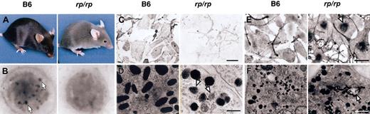 Figure 1. Characteristics of rp/rp mice. Wild-type (B6) data are shown in the left panels and rp/rp in the right. (A) Coat color dilution in rp/rp mice. (B) Lack of platelet dense bodies (arrows) in rp/rp platelets. Magnification × 14 000. (C) Morphology and pigmentation of wild-type (B6, melan-a) and rp/rp immortal mouse melanocytes (bright-field images). Note decreased melanin pigmentation in rp/rp cells. Bar represents 50 μM. (D) Electron microscopy. Melanosomes of rp/rp melanocytes are less numerous than in wild-type melanocytes. All stages of melanosome development are found, as in wild type, but immature stages are more frequent (arrows), and some clustering of melanosomes is seen (not shown). Bar represents 0.5 μM. (E) Tyrosinase localization shown by L-DOPA staining (bright-field microscopy). Tyrosinase accumulates in the perinuclear region in rp/rp melanocytes (arrow) but is well distributed across the cell in wild-type melanocytes. Bar represents 50 μM. (F) Electron microscopy of l-DOPA–stained melanocytes. Mutant melanocytes show DOPA-positive tubular structures (arrow) not seen in wild-type cells. Bar represents 1.0 μM.