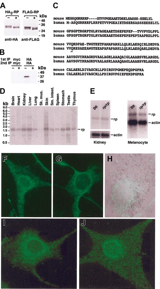 Figure 3. rp encodes a phosphorylated, conserved, widely expressed cytoplasmic protein. (A) Phosphorylation of wild-type RP. Whole cell extracts prepared from MNT-1 cells transiently expressing HA3-RP or FLAG-RP were treated for 1 hour at 37°C in the presence (+)orabsence(–) of alkaline phosphatase. Samples were then subjected to immunoblotting analysis as indicated. The positions of molecular mass markers are indicated on the right. (B) The phosphorylation of RP was confirmed by metabolic labeling of HA3-RP–expressing MNT-1 cells with 32P-orthophosphate in the presence (+) or absence (–) of alkaline phosphatase, followed by immunoprecipitation-recapture with antibodies to the myc (nonspecific control) or HA epitopes. The positions of molecular mass markers are indicated on the right. (C) Comparison of human and mouse RP amino acid sequence reveals an overall identity of 87% (shaded residues). The C>T transition converts amino acid 80 (underlined, glutamine) to a stop codon. (D) OriGene Technologies Northern blot showing expression of rp in mouse tissues. The blot was hybridized with the same 672-bp fragment described for Figure 2C. Molecular weight marker positions are indicated on the left. (E) rp message levels appear normal in kidney (left) and cultured melanocyte (right) mRNA. Note that a lower amount of rp/rp melanocyte mRNA was loaded, as judged by the intensity of the actin signal. Each lane contains 2 μg mRNA. (F-G) Immunofluorescence image of B6 (F) and rp/rp (G) melanocytes transfected with pHM6-RP and stained with anti-HA. No staining was evident in melanocytes transfected with vector alone (not shown). (H) Merged Nomarski and stained (affinity-purified chicken anti-RP peptide antibody recognizing amino acids 1-12 of the RP protein) image showing that RP-containing vesicles (green structures) and melanosomes (dark structures) do not colocalize extensively. (I-J) B6 (I) and rp/rp (J) melanocytes stained with affinity-purified chicken anti-RP peptide antibody. No staining was seen when the primary antibody (affinity-purified chicken anti-RP) was eliminated (not shown). Original magnification × 400 for panels F-J.