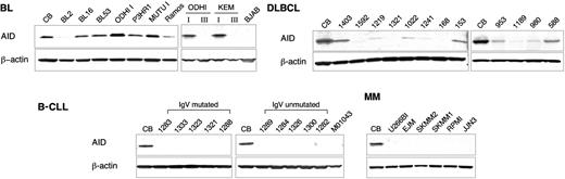 Figure 3. The AID protein is expressed in GC but not in post-GC-derived B-cell malignancies. Western blot analysis of AID expression in BL (top left panels), DLBCL (top right panels), and post-GC-derived B-CLL and MM samples (bottom panels). Both IgV mutated and unmutated cases were included in the B-CLL filter. The top right panel shows 2 pairs of isogenic BL cell lines representative of the group I/latency I and group III/latency III phenotype (see text for a detailed explanation); the B-cell lymphoma line BJAB serves as a negative control, because it does not express AID mRNA (L.P., unpublished results, 2003). In each membrane, equivalent amounts of total protein extracts from purified CBs were included; β-actin controls for loading.