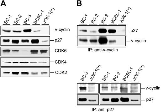 Figure 1. v-cyclin associates with p27KIP1 in PEL cells. (A) Total lysates of PEL cells (40 μg) were resolved by SDS-PAGE (12%) and immunoblotted with antibodies to v-cyclin, p27KIP1, CDK6, CDK4, and CDK2. BC-1, BC-2, BC-3, and BCBL-1 are KSHV-positive PEL cell lines, and JOK-1 cells are KSHV-negative leukemia cells. (B) Lysates of the PEL and JOK-1 cells were immunoprecipitated (IP) with anti-v-cyclin (2 top panels) or anti-p27KIP1 antibodies (2 bottom panels) and analyzed for associated proteins on SDS-PAGE by immunoblotting with anti-v-cyclin and anti-p27KIP1 antibodies. The interaction between v-cyclin and p27KIP1 after immunoprecipitation with anti-p27KIP1 antibodies is readily detectable in a short exposure from BC-3 cells (left), whereas a longer exposure was used for BC-1, BC-2, and BCBL-1 (right).