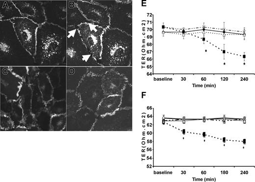 Figure 2. Intercellular gap formation induced by TNF and the effect of antioxidants on TNF-induced TER. Live, unfixed HUVECs (original magnification, × 100) mounted on a heated stage were infected with Ad-VE-cadherin GFP and exposed to vehicle (A) or TNF (B) and were observed under fluorescence confocal microscopy for 30 minutes. Ad-VE-cadherin GFP localized to adherens junctions similar to endogenous VE-cadherin. Compared with vehicle controls (A), TNF caused early separation of cell-cell junctions (B, arrows). In parallel, intercellular gap formation was associated with loss of VE-cadherin GFP from adherens junctions. (C-D) Confluent HUVEC monolayers exposed to the antioxidants (C) NAC (20 mM) or (D) MnTBAP (10 mM) for 30 minutes before TNF exposure. Both NAC and MnTBAP prevented TNF-induced intercellular gap formation and VE-cadherin redistribution. (E-F) Effect of antioxidants on TNF-induced reduction in transmonolayer resistance, TER, and intercellular gap formation. (E) Early and persistent decrease in TER induced by TNF (▪) compared with vehicle controls (□). NAC (▵) prevented TNF-induced decreased TER, whereas NAC alone (×) had no effect on TER. (F) Similar effects were observed with MnTBAP. *P < .05; n > 6 per group.