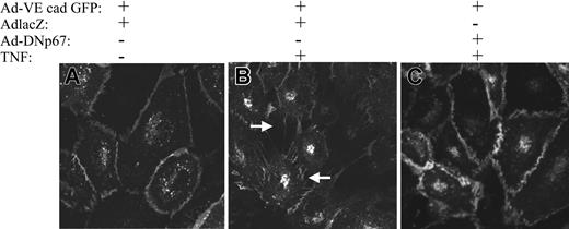 Figure 4. Effect of AdDNp67 on TNF-induced intercellular gap formation VE-cadherin distribution. Live, unfixed HUVECs (original magnification, × 100) were coinfected with Ad-VE-cadherin GFP (A-C) and either Ad-lacZ (A-B) or Ad-DNp67 (C). Monolayers exposed to vehicle (A) maintained cell-cell contacts, and Ad-VE-cadherin GFP was localized to adherens junctions. In contrast, TNF caused marked cell-cell separation, gap formation, and cadherin redistribution in cells co-infected with Ad-lacZ (B). Ad-DNp67 prevented TNF-induced changes (C).