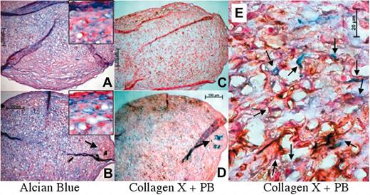 Figure 1. Chondrogenic differentiation is not inhibited by Fe-Pro labeling. Both unlabeled (A) and Fe-Pro-labeled (B) MSC pellets exhibited similar distributions of Alcian blue-stained glycosaminoglycans. Inset shows magnified view (× 100). Staining with collagen X (normally present only in hypertrophic chondrocytes, fetal cartilage, cartilage at growth plates of long bones, and neoplasms arising from chondrocytes) followed by Prussian Blue (PB) shows positive collagen X expression both in unlabeled (C) and Fe-Pro-labeled (D) MSC pellets.4 Magnified view shows collagen X expression in iron-positive cells (E, multiple arrows). Note the lack of Alcian blue stain and expression of collagen X in the cells around extracellular iron oxide complexes (arrow in B, arrow in D). The bars on A-D represent 100 μm and the bar on E represents 20 μm. Photomicrographs were visualized under a Zeiss Axioplan Imaging II microscope (Carl Zeiss, Oberkochen, Germany) equipped with 10×/0.50 (A-D) or 100×/1.30 (A inset, B inset, E) oil immersion objective lenses (Carl Zeiss). Images were acquired with Axiovision 4 software (Carl Zeiss) and processed with Adobe Photoshop 7.0 software (Adobe, San Jose, CA).