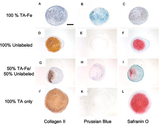 Figure 1. Chondrogenic differentiation of MSCs is inhibited after magnetic labeling with ferumoxides. Human MSCs exposed to TA-Fe (A-C) exhibit normal viability, with Prussian Blue staining revealing Fe-containing cells throughout the pellet (B), but fail to demonstrate chondrogenic differentiation (A,C). In contrast, donor MSCs unexposed to TA-Fe exhibit normal chondrogenesis (D-F). To further prove that Fe labeling inhibits chondrogenic differentiation, experiments were performed with 50:50 mixtures of TA-Fe-labeled and unlabeled MSCs (G-I). Only unlabeled, non-Fe-labeled cells (Prussian Blue-negative region in panel H) demonstrate chondrogenesis. Thus, the inhibition of chondrogenesis is mediated by Fe, and not by the TA, as MSCs labeled with only TA (J-L) differentiate normally. All experiments were performed with the same donor cells and passage number. Bar in panel A represents 400 μm. Thin sections of pellets were cleared though xylene and ethanol, then rehydrated. For collagen II indirect immunostaining, sections were reacted against monoclonal antibody C4F6; the brown positive signal was composed of precipitated di-amino-benzidine (DAB). Prussian Blue and safranin O stains were performed as previously described. Sections stained for collagen II and safranin O were also briefly exposed to hematoxylin, to color nuclei blue. Once staining was complete, sections were dehydrated and mounted under No. 1 coverslip glass in Permount (Fisher Scientific, Hampton, NH). The slides were observed at room temperature (22°C) with an Eclipse E400 microscope (Nikon USA, Melville, NY), using a Nikon Plan Fluor 4×/0.13 dry objective lens. Digital images were captured with an attached SPOT RT Slider 2.3.0 digital camera (Digital Instruments, Sterling Heights, MI) using the manufacturer's proprietary capture software (SPOT 4.0.5). Files saved under the JPEG format were then opened in Photoshop 6.0 (Adobe Systems, San Jose, CA), cropped, and combined into a single composite image. Red-Green-Blue colorspace was then adjusted with a single use of the “Levels” command for each set of four similarly-stained pellet sections.