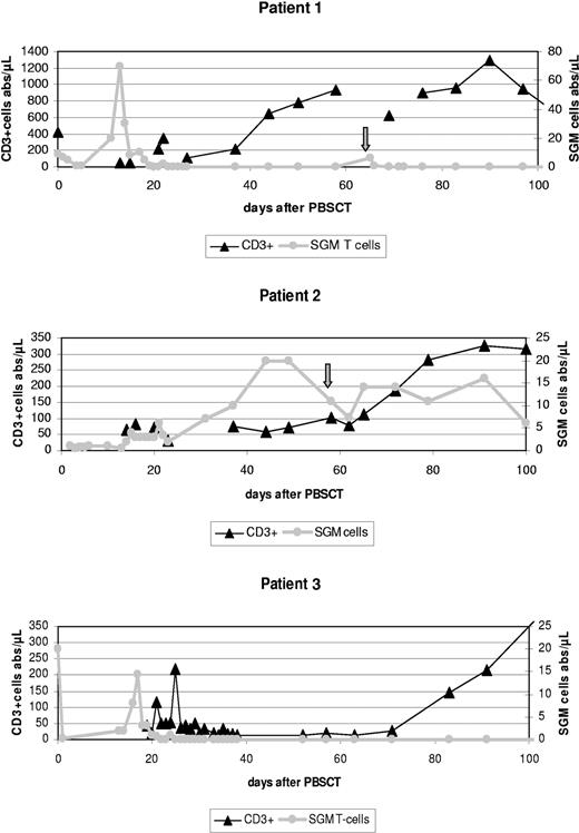 Figure 1. Absolute CD3+ T-cell counts (including CD3+CD56+) and numbers of suicide gene-modified (SGM) donor T lymphocytes during the first 100 days after PBSCT in all 3 patients treated according to our protocol. Patient 2 showed stable numbers of SGM cells for about 3 months accompanied by increasing absolute CD3+ counts and full donor chimerism. In contrast, in both patients 1 and 3 early in vivo depletion of SGM donor T lymphocytes was observed, mediated by ganciclovir applied to treat an acute GvHD grade II (patient 3) or most probably as the result of an anti-HSV-thymidine kinase (tk) immune reaction (patient 1). Both patients appeared to have higher absolute CD3+ counts on day 100 compared with patient 2, but developed mixed chimerism (not shown) and eventually rejected their grafts at days 156 and 119. Arrows indicate a second donor SGM T lymphocyte infusion in patient 1 (day 65) and patient 2 (day 58). Note that different Y-axes should be applied to CD3+ and SGM cells.