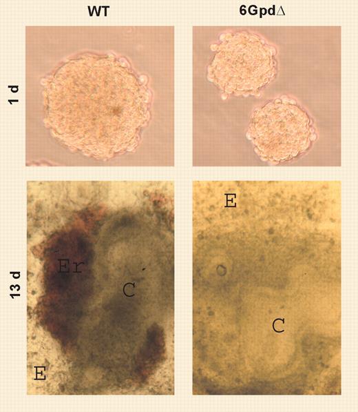 WT and G6pdΔ EB morphology. See the complete figure in the article beginning on page 3148.