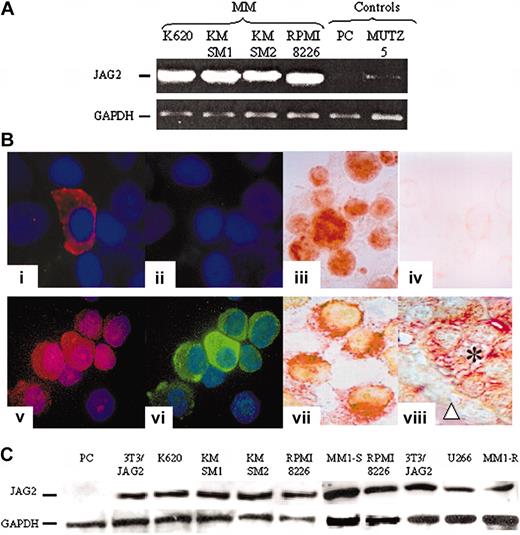 Figure 2. JAG2 expression. (A) Representative result of RT-PCR experiments assessing the levels of JAG2 transcripts in JAG2-negative (MUTZ5-ALL) and normal plasma cells (PC) and JAG2-positive (KMSM-1 and -2, K620, RPMI 8226) cell lines. GAPDH levels were used to normalize the amount of cDNA present in each tube. (B) Comparative immunostaining results. Normal nonpurified (1-2) and MM (5-6) plasma cells stained with an anti-CD138 (1,5) and anti-JAG2 (2,6). Panels 3 and 4 are a representative (K620) MM cell line stained with the anti-JAG2 (3) and goat isotype (4) antibodies; panels 7 and 8 show double color staining anti-CD138 (Fast Red) and -JAG2 (DAB) of an MM cell line (KMSM-1) (7) and a paraffin section from an MM patient sample (8). (C) Western blot analysis of normal PC, a NIH 3T3 cell line overexpressing JAG2, and 7 MM cell lines (K620, KMSM-1 and -2, RPMI 8226, U266, MM1-S and -R).