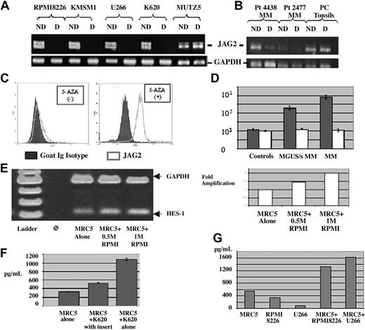 Figure 4. Methylation status. PCR on NotI-digested and undigested DNA from (A) MM JAG2-positive and -negative (MUTZ5) cell lines with primers located on either side of the NotI site. The JAG2-positive line shows the absence of a band when digested (hypomethylated promoter region), whereas the negative line shows no difference (hypermethylated promoter region). (B) A similar PCR pattern was obtained on NotI-digested and undigested DNA from 2 MM JAG2-positive samples (4438, 2477) and (JAG2-negative) tonsil plasma cells using the same primers. The JAG2-positive samples show a reduction of band when digested (hypomethylated promoter region), whereas the JAG2-negative cells show no difference (hypermethylated promoter region). The profile with MM patient DNA presents a reduction of band intensity, certainly due to the nonpurity of the plasma cells after purification. ND indicates not digested; D, digested. (C) JAG2 expression profile in the MUTZ5 cell line before (left panel) or after incubation with 5-azacytidine (right panel). Blocking of methylation with 5-AZA induced JAG2 expression in the negative cell line, comparable to the levels observed in MM. (D) Representation of the JAG2 expression levels differential between controls, MGUS/smoldering MM, and MM samples per cell lines. (E) RT-PCR with HS-1 and GAPDH-specific primers on RNA extracted from MRC5 cells after coculture with 0.5 million and 1 million MM cells. The induction of HES-1 expression is proportional to the activation signal per number of MM cells in the coculture (right panel). (F) IL-6 detection assay by ELISA for the assessment of IL-6 secretion with MRC5 cells alone, MRC5 cells cocultured with K620 cells (MM) in an insert (no contact between the two cell types), and MRC5 cells cocultured with K620 cells. (G) VEGF secretion measured by ELISA in the MM cells alone (RPMI 8226 and U266) or when cocultured with the MRC5 cells. Error bars (panels D and F) represent standard deviation.