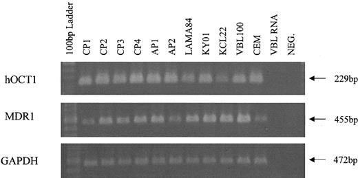 Figure 4. hOCT1 and MDR1 expression in cell lines and primary CML cells. RT-PCR products were run on an agarose gel to show expression of the hOCT1 and MDR1 genes. The expected 229-bp product for hOCT1 and the 455-bp product for MDR1 were present in VBL, CEM cell lines, and CML cell lines LAMA84, KYO1, and KCL22. Both hOCT1 and MDR1 were expressed in 4 cases of CP (CP1 to CP4) and 2 cases of AP (AP1 and AP2). The 472-bp product for GAPDH gene expression was present in all cell lines and CML cells.