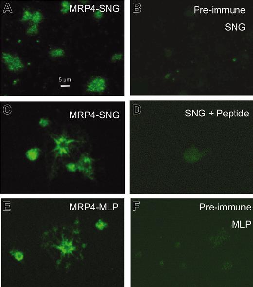 Figure 2. Immunofluorescence microscopy analysis of MRP4 localization in human platelets. Platelets were adhered on collagen, fixed, permeabilized, and incubated with the primary anti-MRP4 antibodies SNG (A, C) and MLP (E) or, as control, with the respective preimmune sera (B, F). (D) Staining with SNG after preincubation with the synthetic peptide used to generate the SNG antiserum. Images were obtained by confocal laser scanning microscopy using an Alexa488-conjugated antirabbit secondary antibody and identical parameters for each set.