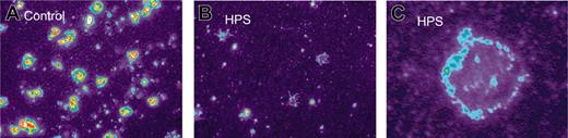 Figure 4. Altered localization of MRP4 in platelets from HPS patients. Platelets adhered to collagen were stained by the anti-MRP4 antibody SNG and a tetramethylrhodamine isothiocyanate–labeled secondary antibody (1:200) as described in “Patients, materials, and methods.” Differences in fluorescence were enhanced using pseudocolor (× 100 magnification, MetaMorph Imaging series 4.6 software, Visitron Systems, Puchheim, Germany). Control platelets (A) show membrane staining and 1 to 3 strong staining clusters, most likely resembling dense granules, whereas HPS platelets mostly showed membrane staining only (B). Higher magnification of HPS platelet (C).