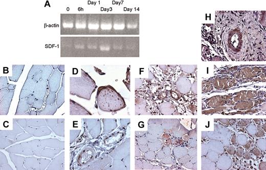 Figure 9. SDF-1 regulation in adductor muscle following ischemia. (A) Semiquantitative RT-PCR using RNA obtained from an RNA pool of at least 3 animals at each indicated time point showed an up-regulation of the SDF-1 mRNA above control peaking at day 3 following ischemia. Up-regulation of SDF-1 mRNA above control is evident starting 6 hours following induction of ischemia. (B) Negative control for SDF-1 immunohistochemistry in tissue sections of normoperfused mice. (C-E) Immunohistochemistry of SDF-1 in adductor muscles of normoperfused mice. Expression of SDF-1 was generally very low (C), but expressed in satellite cells of some small muscle fibers (D). In nonischemic muscles SDF-1 was also expressed, although at low levels, in arterioles (E). (F-G) At 6 hours after ischemia, SDF-1 was up-regulated in arterioles (F) and muscle fibers associated to infiltrating cells showing strong immunoreactive staining (G). (H-I) At day 3, a strong up-regulation in SDF-1 protein expression was observed in the adductor muscle both at arteriole (H) and muscle fibers levels (I). (J) SDF-1 was expressed in regenerating muscle fibers, showing centrally located nuclei, at 7 days after ischemia.