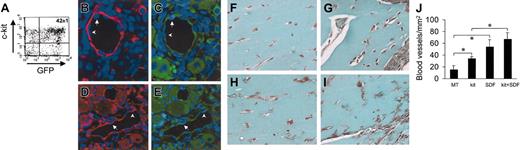 Figure 11. Effect of SDF-1 on in vivo differentiation of c-kit+ cells. (A) C-kit+ cells were obtained from mice ubiquitously expressing GFP protein. FACS analysis of GFP+/c-kit+ cells purified from these mice by MACS. (B-E) GFP+/c-kit+ cells were injected into adductor muscles at the time of femoral artery dissection. (B-C) Expression of GFP (green fluorescence) and α-actin (red fluorescence) in 2 consecutive sections. (D-E) Expression of GFP (green fluorescence) and VWF (red fluorescence) in 2 consecutive sections. The presence of GFP+ (arrows) and GFP– (arrowheads) endothelial cells is shown. (F-J) Trichrome-Masson staining of MT plugs containing SDF-1 and/or c-kit+ cells. (F) Background angiogenesis in MT-only injected mice. (H) A relative increase in the number of small vessels by injecting MT-containing c-kit+ cells. (G,I) An enhanced number of blood vessels in MT–SDF-1 (G) and MT–SDF-1/c-kit+ cell injected mice. (J) Quantification of the total blood vessel density (expressed as blood vessels/mm2) in MT plugs in all experimental conditions. *P < .05; n = 4, for each mice group. Error bars indicate standard errors.