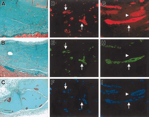 Figure 12. Effect of SDF-1 on formation of tubulelike structures by GFP+/c-kit+ cells in MT plug assay. (A-C) Trichrome-Masson staining of MT plugs containing GFP+/c-kit+ cells (A) and GFP+/c-kit+ cells and 100 ng/mL SDF-1 (B-C). Comparing panel A with panels B-C, it is evident that in SDF-1/c-kit+ cells containing MT the formation of bigger tubulelike structures, which were interconnected by a higher number of branching points, occurred. (D-I) Immunohistochemistry for VWF (D,G), GFP (E,H), and Hoechst staining (F,I) in transverse section of MT plugs containing c-kit+ cells obtained from BM of GFP transgenic mice alone (D-F) or in the presence of 100 ng/mL SDF-1 (G-I). Note that in the presence of stem cells only, sparse and smaller structures were formed (arrows in D-F), while addition of the chemokine induced the formation of more organized cordlike structures that stained positive and negative for GFP (arrows and arrowheads, respectively, in G-I).