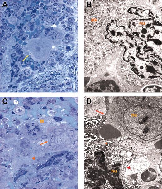 Figure 1. Representative MKs. Representative MKs in consecutive semithin (A,C) and ultrathin (B,D) spleen sections from wild-type (A-B) and GATA-1low (C-D) mice. The arrow in panel A indicates an isolated MK in the semithin section from a wild-type spleen further analyzed by TEM in panel B. The ultrastructural morphology (cytoplasm rich in α granules and platelet territories, PF) characterizes this cell as a stage III MK. The arrow and arrowhead in panel C indicate MKs within a cluster in a semithin spleen section from GATA-1low mice further analyzed by TEM in panel D. Two populations of mutant MKs were identified by TEM, one with normal (arrow) and the other with high (arrowhead) electron density of the nucleus (nu) and cytoplasm. The M in panel C indicates a mitotic MK. The asterisk in panel D indicates structures with plateletlike morphology. Similar observations were obtained with spleens and marrows from 2 additional wild-type and GATA-1low littermates. Original magnifications × 100 (A,C) and × 3000 (B,D).