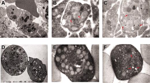 Figure 3. Ultrastructural analysis and immunogold labeling for VWF and P-selectin. Ultrastructural analysis (A,D) and immunogold labeling for VWF (B,E) and P-selectin (C,F) of platelets purified from the blood of wild-type (A-C) and GATA-1low (D-F) mice. Original magnification × 20 000 (A,D) and × 30 000 for all other panels. Arrows indicate representative immunogold particles.