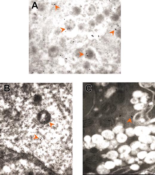 Figure 4. Immunogold labeling for wild-type and GATA-1low MKs. Immunogold labeling for VWF of the cytoplasm from a stage III wild-type MK (A) and from representative light (B) and heavy (C) electron-dense GATA-1low MKs. Representative immunogold particles are indicated by arrowheads. In normal MKs, VWF-immunoparticles are often localized at one pole of typical α granule structures. In comparison, the cytoplasm of GATA-1low MKs contains lower numbers of gold particles localized both in α granule–like structures and in the cytoplasm (B). Note how few VWF particles are present in the cytoplasm of a heavy electron-dense GATA-1low MKs. Original magnification × 30 000 for all panels.