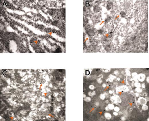 Figure 5. Immunogold labeling for P-selectin of the cytoplasm from stage I and III wild-type MKs and from light and heavy electron-dense GATA-1low MKs. (A) Normal stage I MKs are weakly labeled for P-selectin. (B) Normal stage III MKs present many P-selectin gold particles mainly in association with α granules and rarely with the DMS. In contrast, light electron-dense GATA-1low MKs present few gold particles localized both on the membrane of granulelike structures and on the initial DMS (C), whereas high electron-dense Gata-1low MKs show numerous gold particles mostly associated with DMS, rarely on vacuoles or dispersed in the cytoplasm (D). Arrows and arrowheads indicate gold particles associated with granules (either α or atypical) and with DMS, respectively. Original magnification × 30 000 for all panels.
