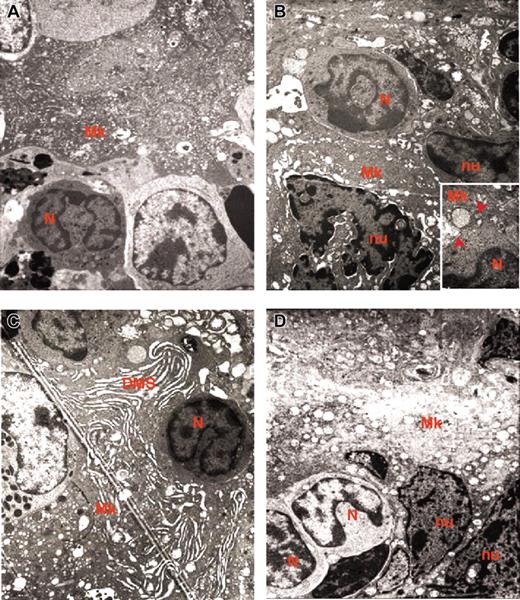 Figure 6. Sequential phases of neutrophil emperipolesis in MKs from the spleen of GATA-1low mouse. The different panels present a neutrophil (N) approaching the MK (A); establishing contacts with the MK (B) and fusing its own membrane with that of the MK (arrowheads in the insert in panel B); penetrating the MK through the DMS (C). Finally, panel D shows 2 neutrophils enclosed inside the MK cytoplasm. Note that in this last case, the MK cytoplasm appears highly vacuolated, a sign of cell damage, whereas the cytoplasm of the neutrophil appears degranulated. Nu indicates nuclear area of the MK. Original magnification × 3000 for all panels and × 30 000 for the insert.